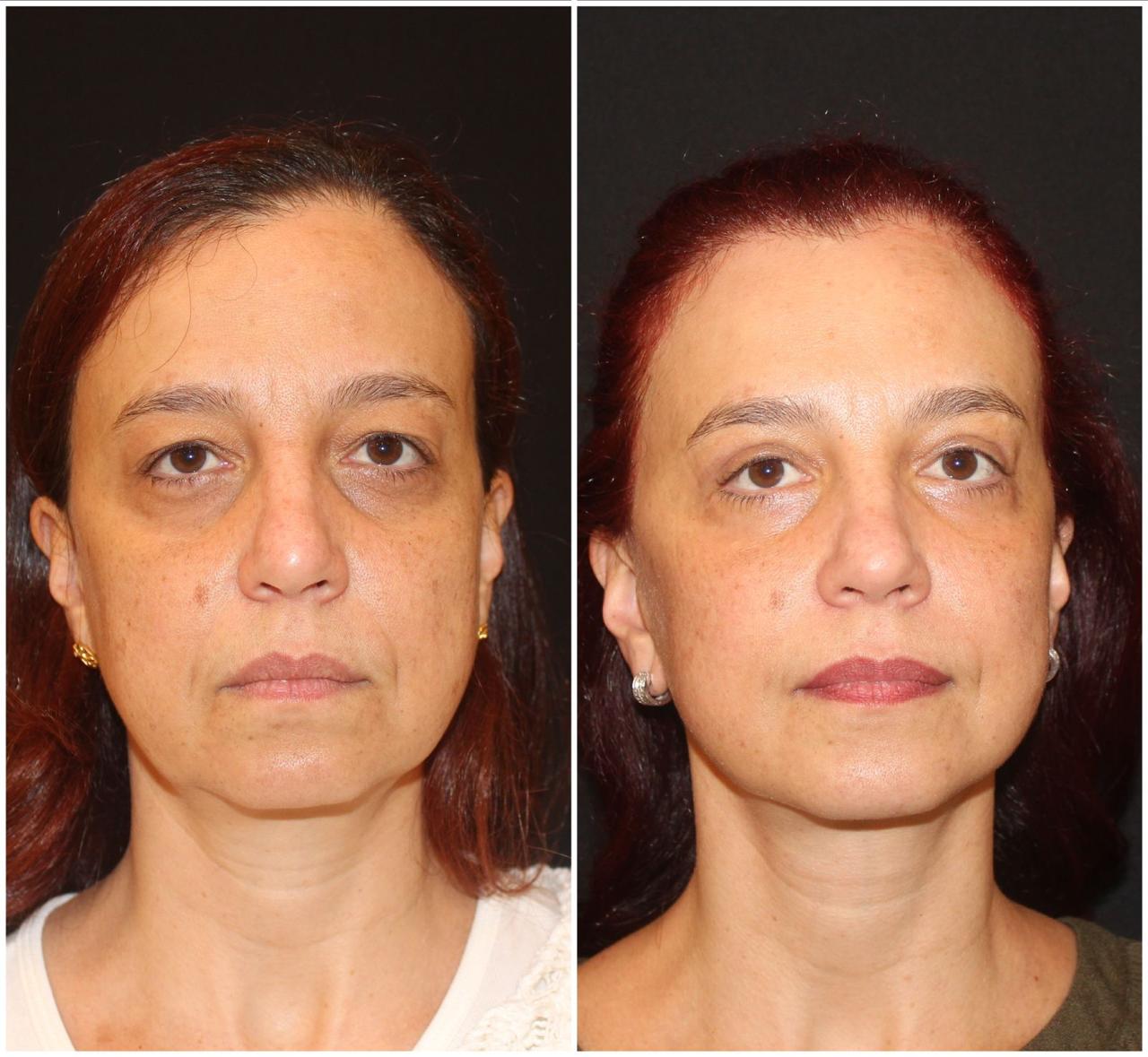 WhatsApp Image 2025-02-05 at 14.49.13 (1)